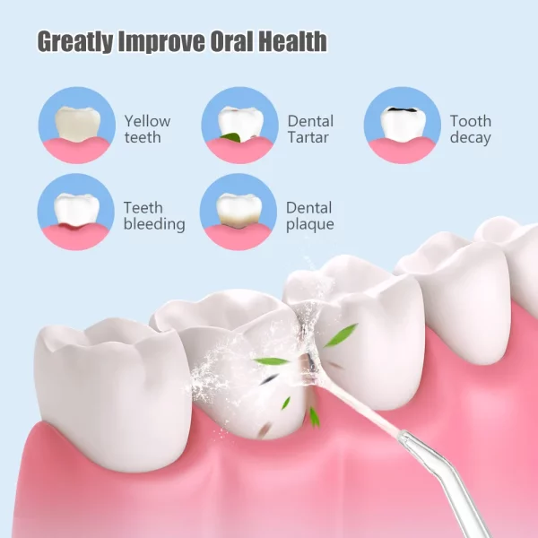 Oral Irrigator Portable Dental Water Flosser USB Rechargeable Water Jet Floss - Image 3